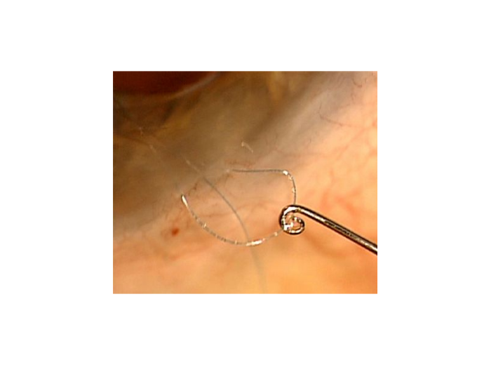Devgan Intraocular Suturing Hook